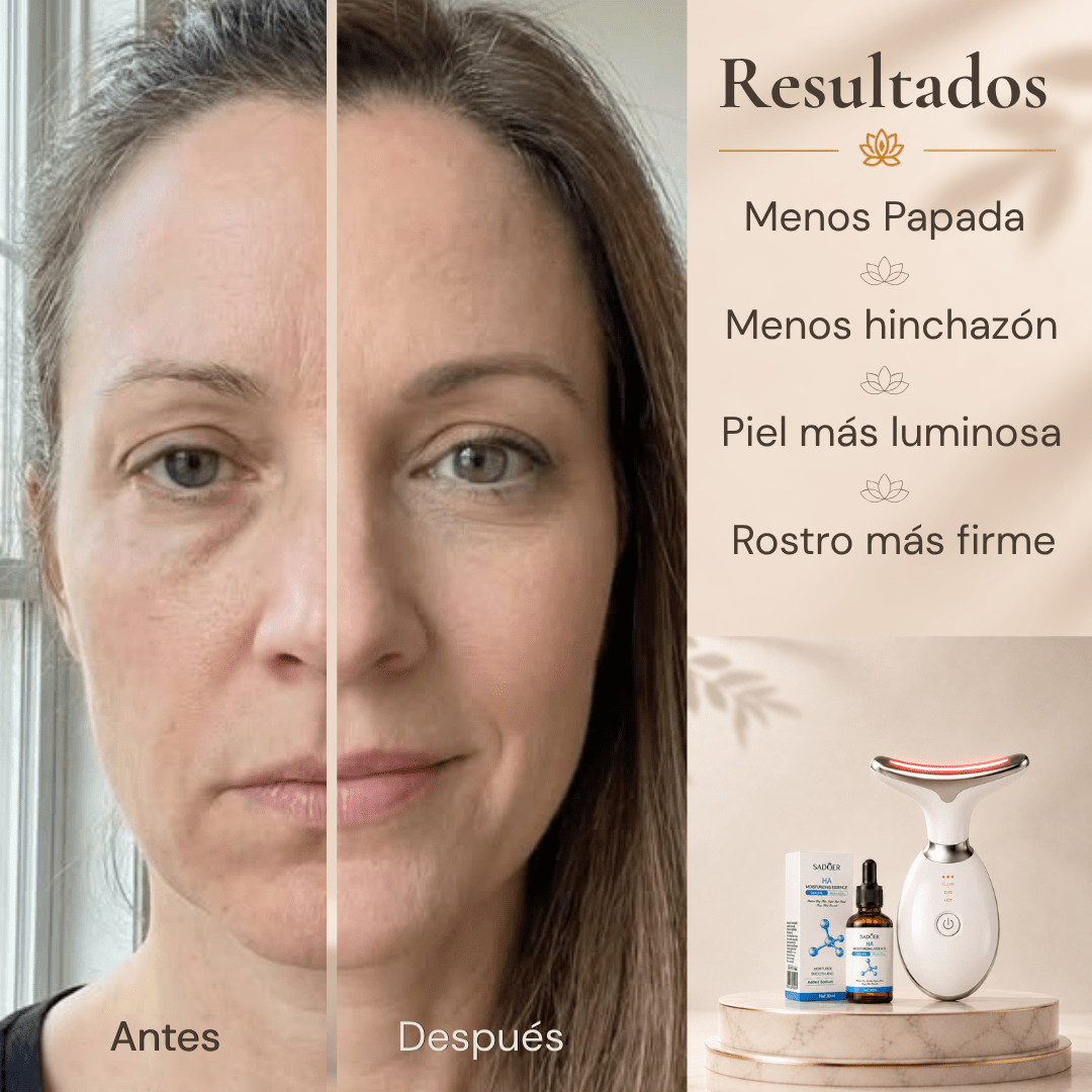 Ritual Lifting Bloom - Masajeador Facial + Esencia Hialurónica